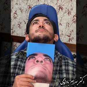 جراحی-بینی-01
