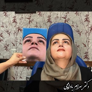 جراحی-بینی-02