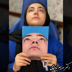 جراحی-بینی-05