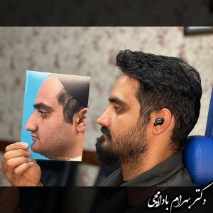 جراحی-بینی-08