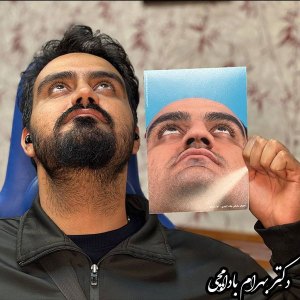 جراحی-بینی-09