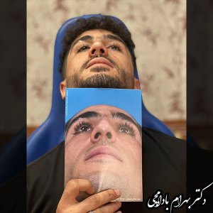 جراحی-بینی-19