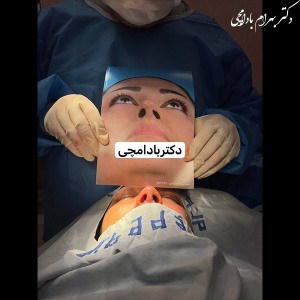 جراحی-بینی-22
