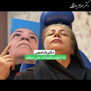 جراحی-بینی-25