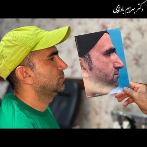جراحی-بینی-29