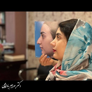 جراحی-بینی-31