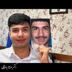 جراحی-بینی-37