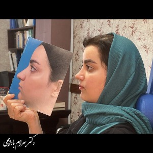 جراحی-بینی-48