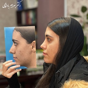 جراحی-بینی-74