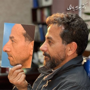 جراحی-بینی-76