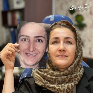 جراحی-بینی-77