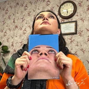 جراحی-بینی-81
