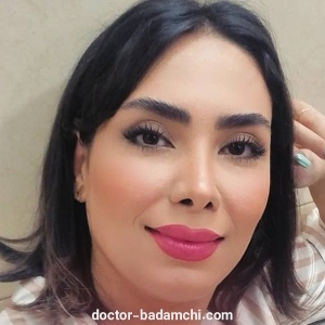 rhinoplasty-104
