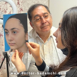 rhinoplasty-119
