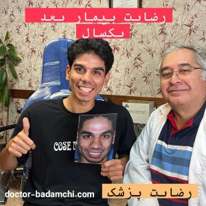 rhinoplasty-91