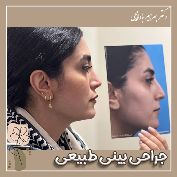 جراحی بینی طبیعی + دکتر بادامچی