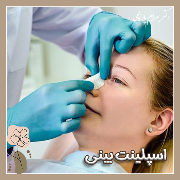 اسپلینت بینی + دکتر بهرام بادامچی