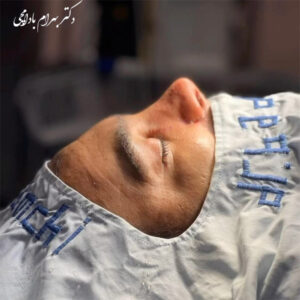 عمل بینی فانتزی پسرانه 