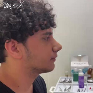 عمل بینی فانتزی پسرانه 