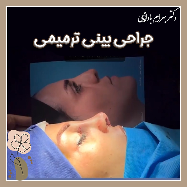 جراحی بینی ترمیمی + دکتر بهرام بادامچی