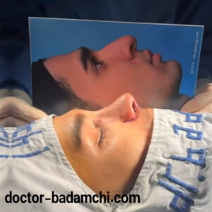 نمونه کار عمل بینی طبیعی دکتر بادامچی