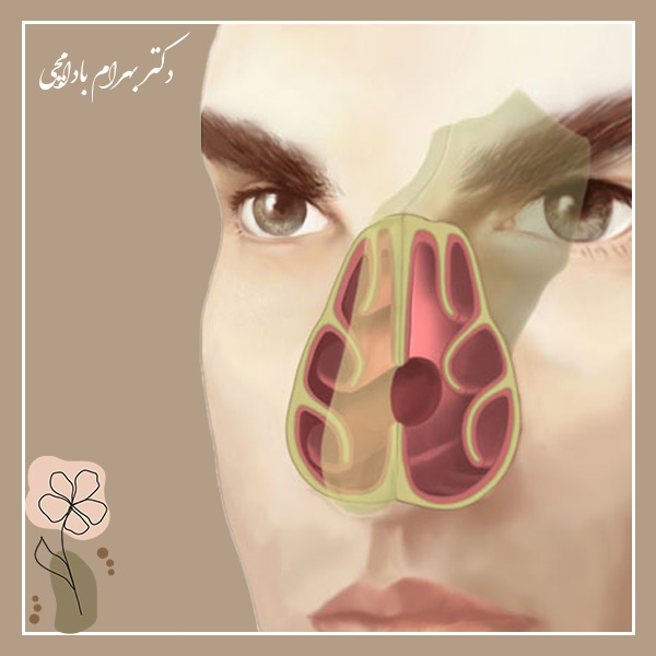 سوراخ شدن تیغه بینی + دکتر بهرام بادامچی