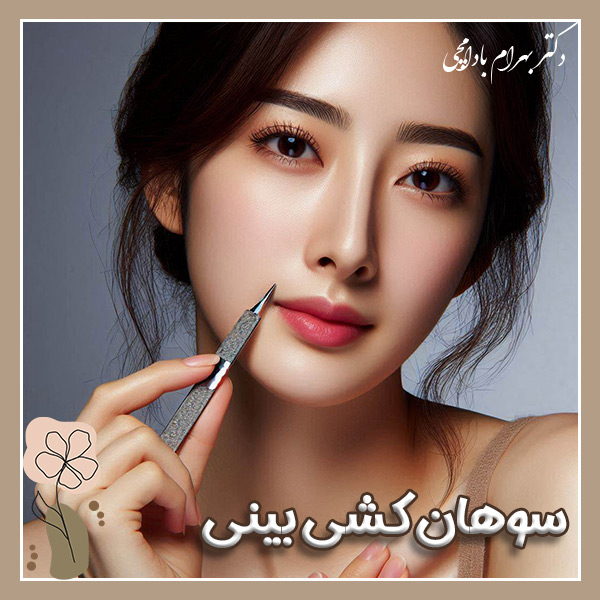 سوهان کشی بینی + دکتر بهرام بادامچی