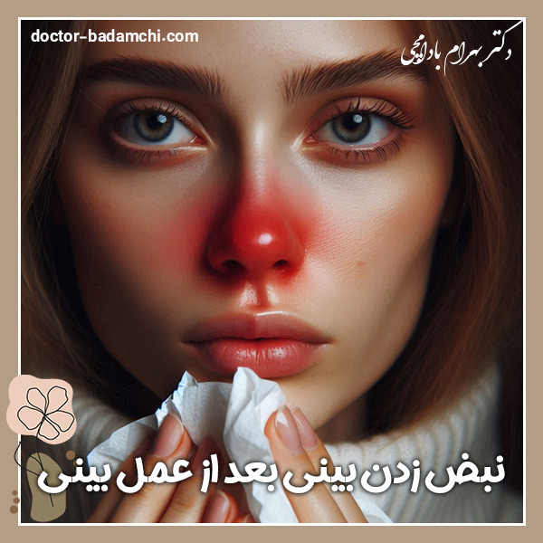  نبض زدن بینی بعد از جراحی بینی - دکتر بهرام بادامچی