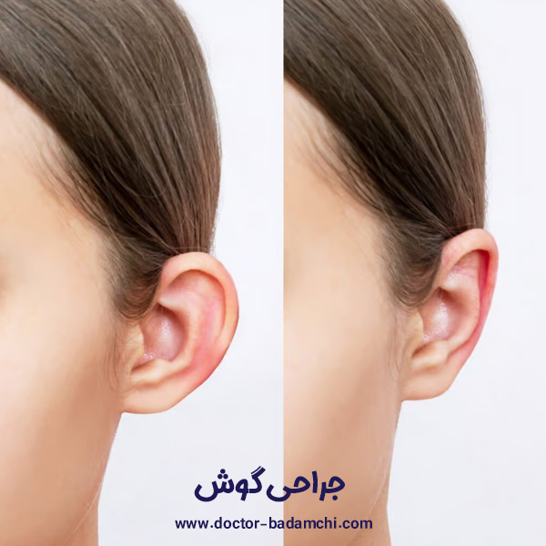 جراحی گوش در تهران | دکتر بهرام بادامچی