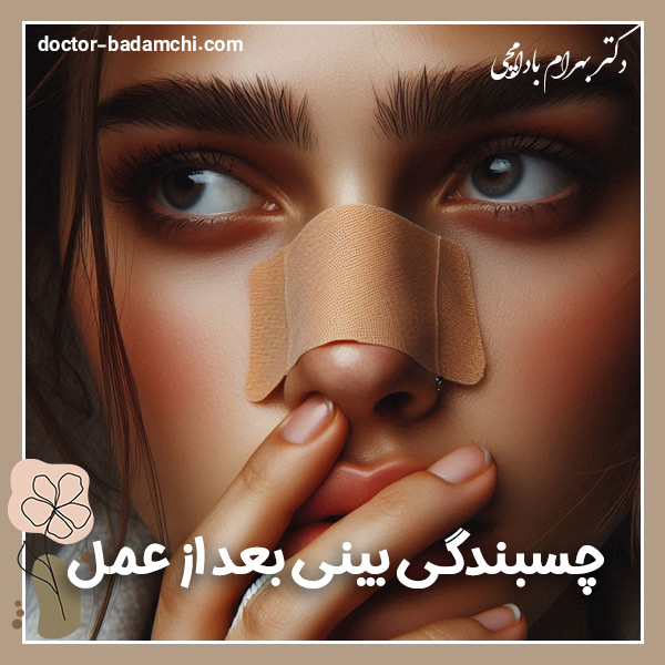 چسبندگی بینی بعد از عمل + دکتر بهرام بادامچی