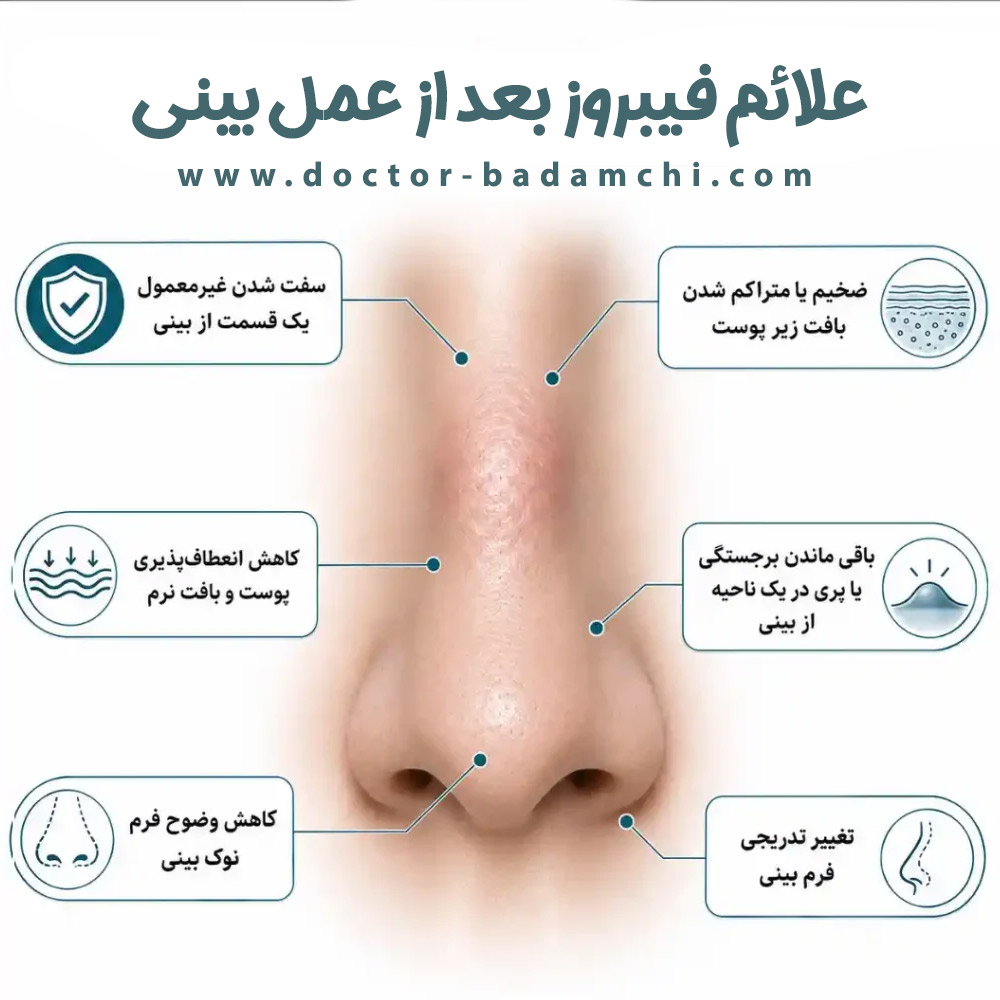فیبروز بعد از عمل بینی + دکتر بهرام بادامچی