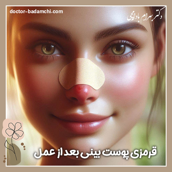 قرمزی پوست بینی بعد از عمل + دکتر بهرام بادامچی