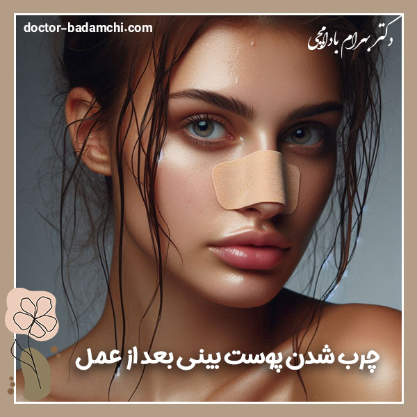 چرب شدن پوست بینی بعد از عمل + دکتر بهرام بادامچی