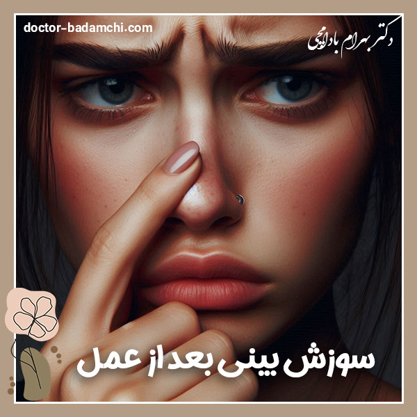 سوزش بینی بعد از عمل + دکتر بهرام بادامچی