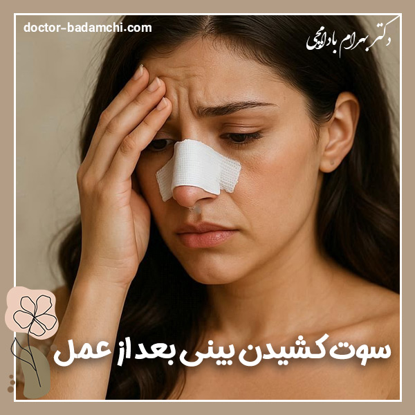 سوت کشیدن بینی بعد از عمل + دکتر بهرام بادامچی