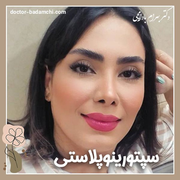 سپتورینوپلاستی + دکتر بهرام بادامچی