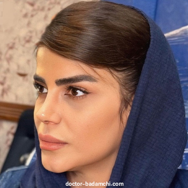 نمونه کارهای متخصص بینی گوشتی در تهران دکتر بهرام بادامچی