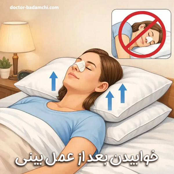 خوابیدن بعد از عمل بینی گوشتی + دکتر بهرام بادامچی
