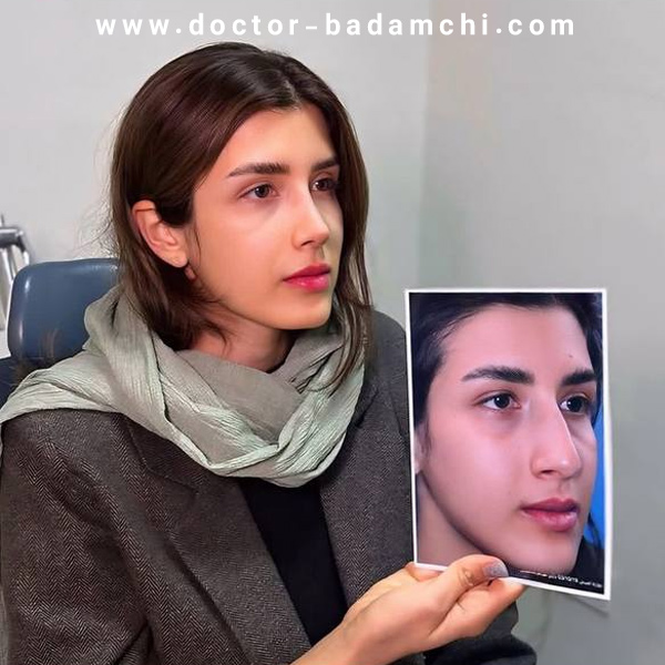 جراح بینی گوشتی در تهران | دکتر بهرام بادامچی